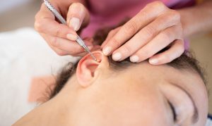REP-blog-Auricular-Acupuncture-1685x1006px